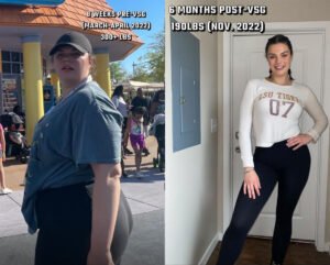 رحلتي لعلاج السمنة – كيمي شانون – الحياة بين النساء