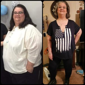 رحلتي لعلاج السمنة – ستيفاني جارو